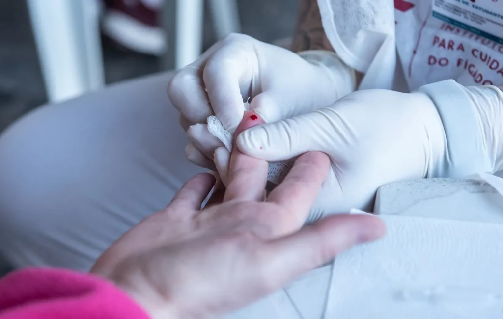 Surto de Hepatite A: Curitiba confirma novos casos da doença